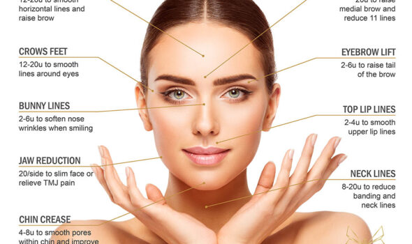 botox-guidelines-01-web